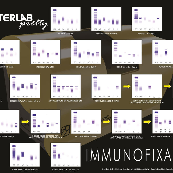 poster_IMMUNOFIXATION_pretty